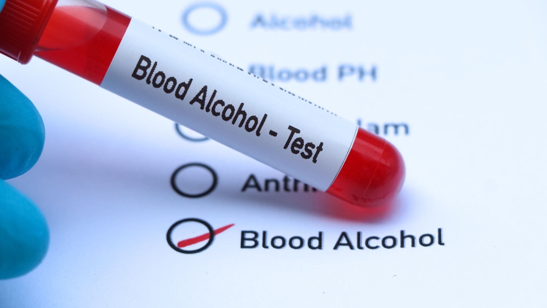 Prueba de Concentración de Alcohol en la Sangre